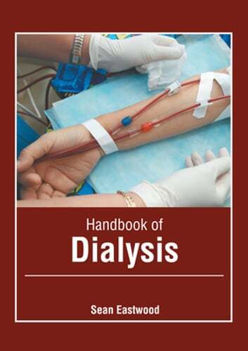 Handbook of Dialysis by Sean Eastwood: New