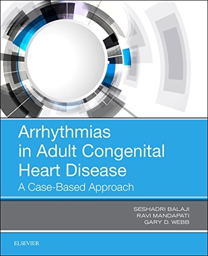 ARRHYTHMIAS IN ADULT CONGENITAL HEART DISEASE: A By Seshadri Mbbs Balaji Mint