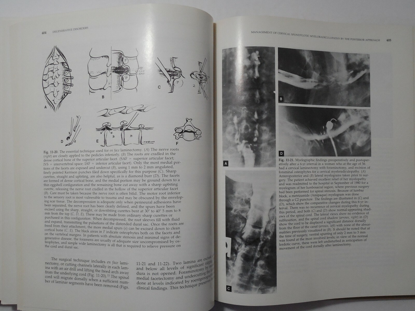 The Cervical Spine by The Cervical Spine Research Society, 1983, Like New