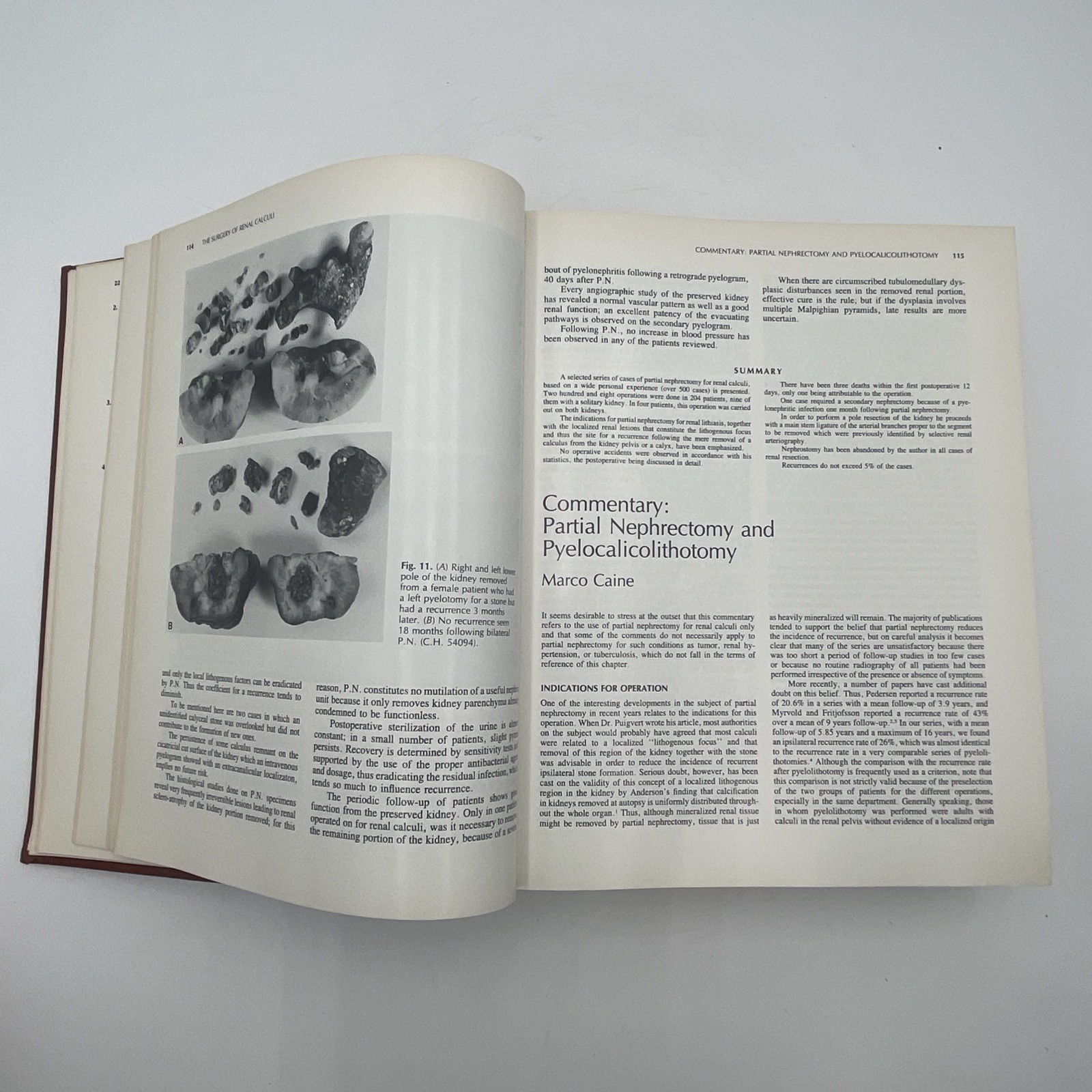 Current Operative Urology Second Edition 1994 1st Printing, E. Douglas Whitehead