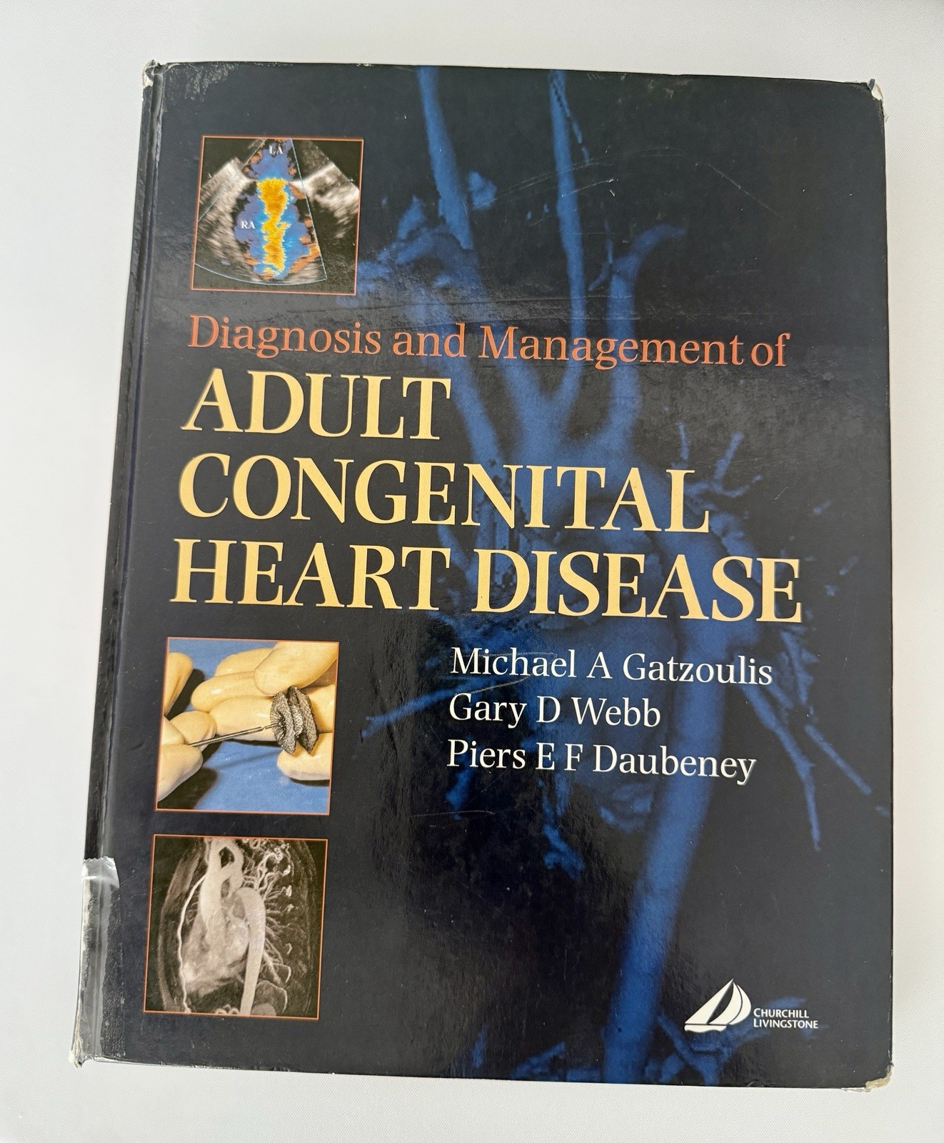 Diagnosis and Management of Adult Congenital Heart Disease Hard Cover