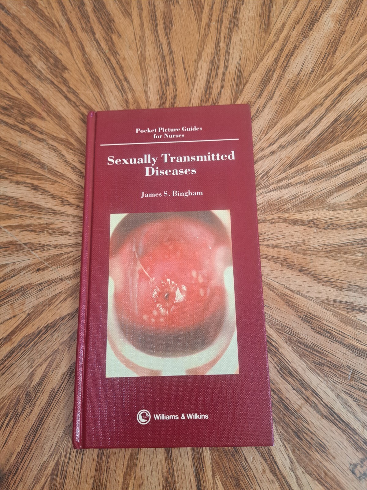 Pocket Pictures Guide To Clinical Medicine Sexually Transmitted Diseases