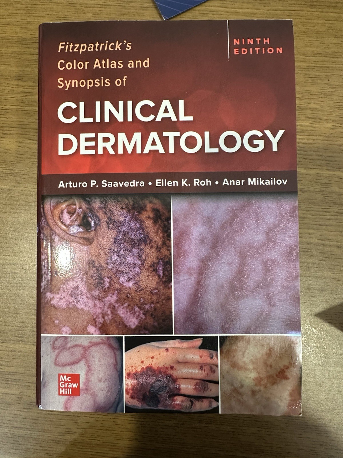 Fitzpatrick’s Color Atlas and Synopsis of Clinical Dermatology, Ninth Edition