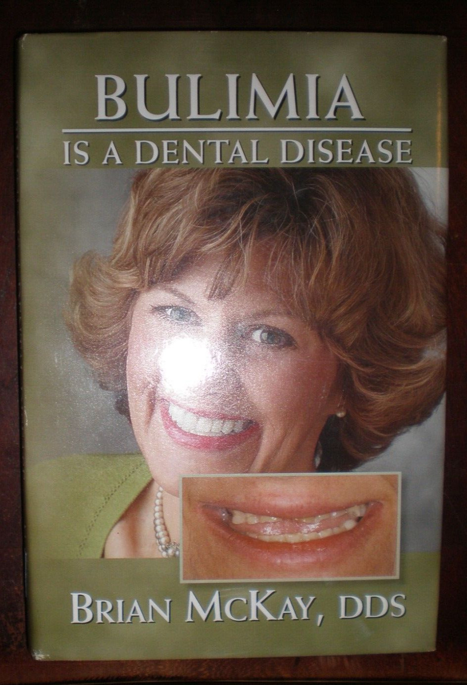 BULIMIA IS A DENTAL DISEASE COPYRIGHT 2008 190 PAGES LIKE NEW
