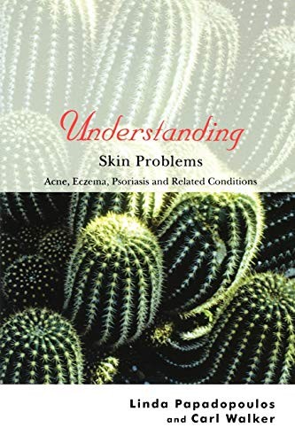 Understanding Skin Problems: Acne, Ecze…, Carl Walker