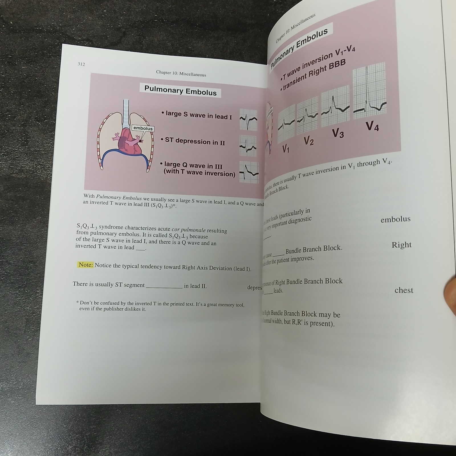 Rapid Interpretation of EKG’s 6th Edition Dale Dubin 2000 Paperback