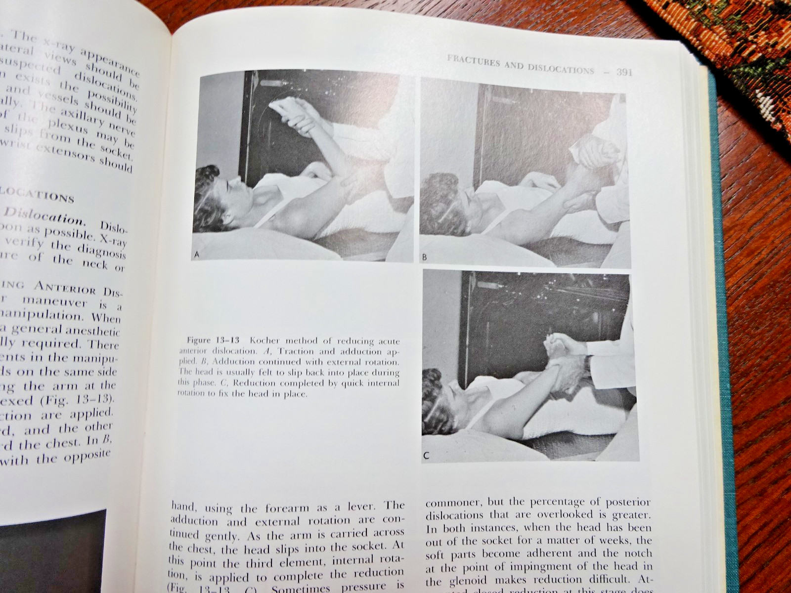 The Shoulder and Neck James E Bateman 1972 618 pages, lots of pics, Very Good
