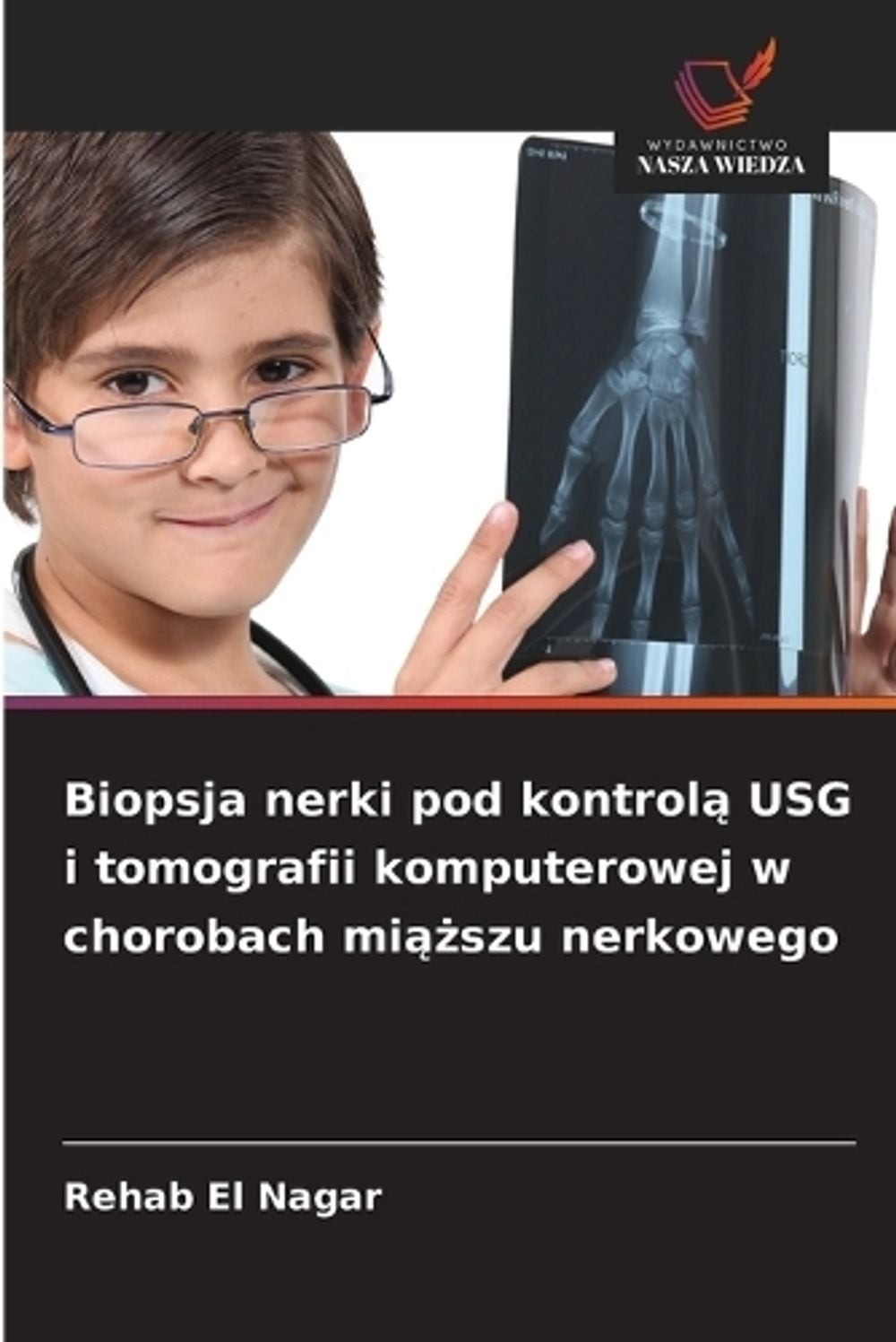 Biopsja nerki pod kontrol USG i tomografii komputerowej w chorobach miszu nerkow