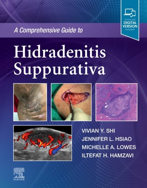COMPREHENSIVE GUIDE TO HIDRADENITIS SUPP by Vivian Y., MD Associate Professor