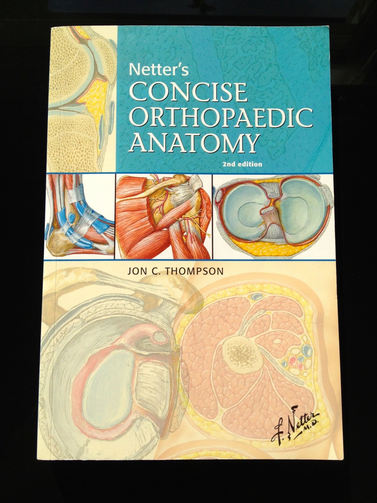 Netter’s Concise Orthopaedic Anatomy (Netter Basic Science)