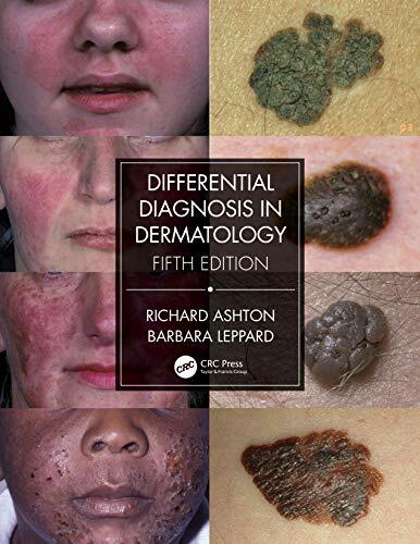 Differential Diagnosis in Dermatology, Ashton, Leppard 9780367085971 New**