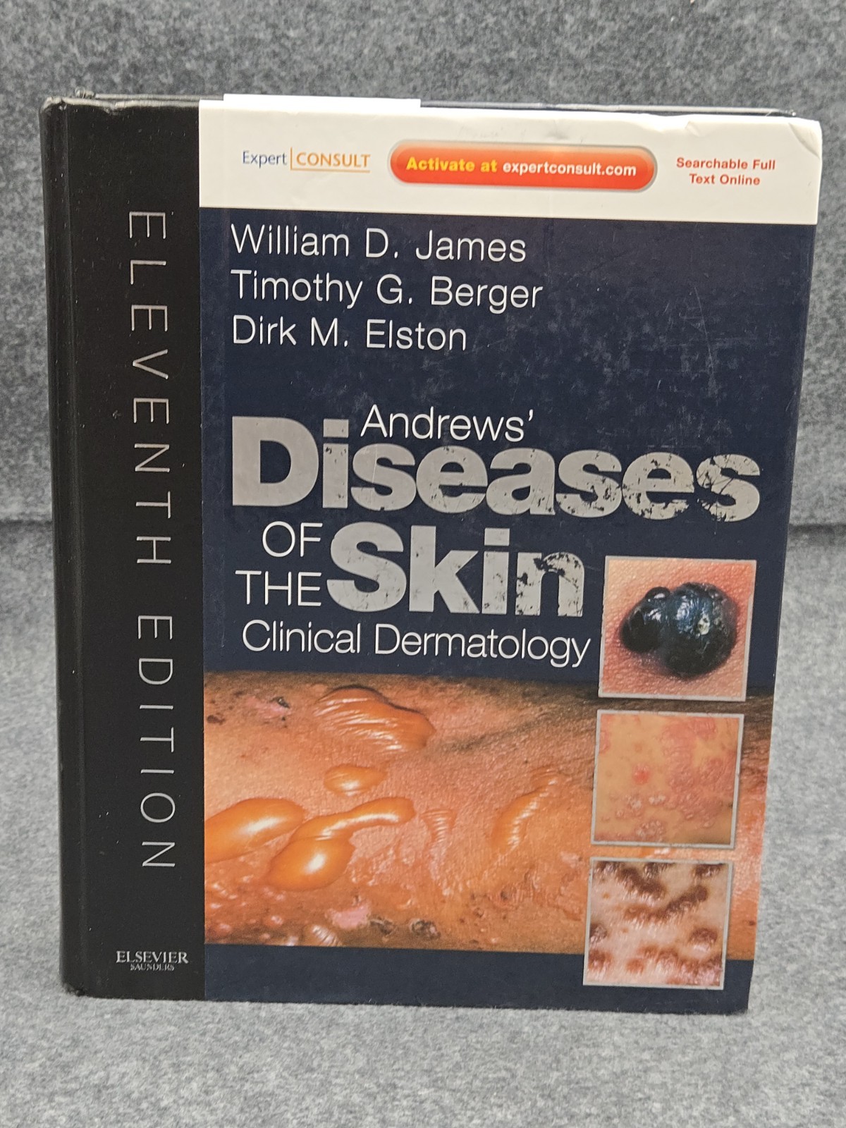 Andrews’ Diseases of the Skin : Clinical Dermatology Hardcover