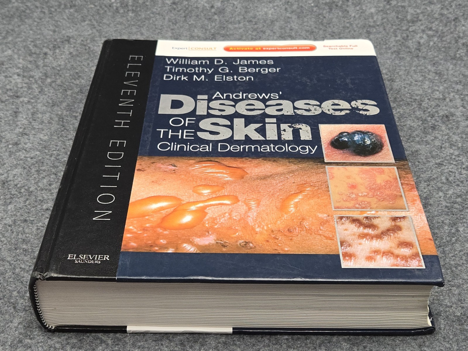 Andrews’ Diseases of the Skin : Clinical Dermatology Hardcover