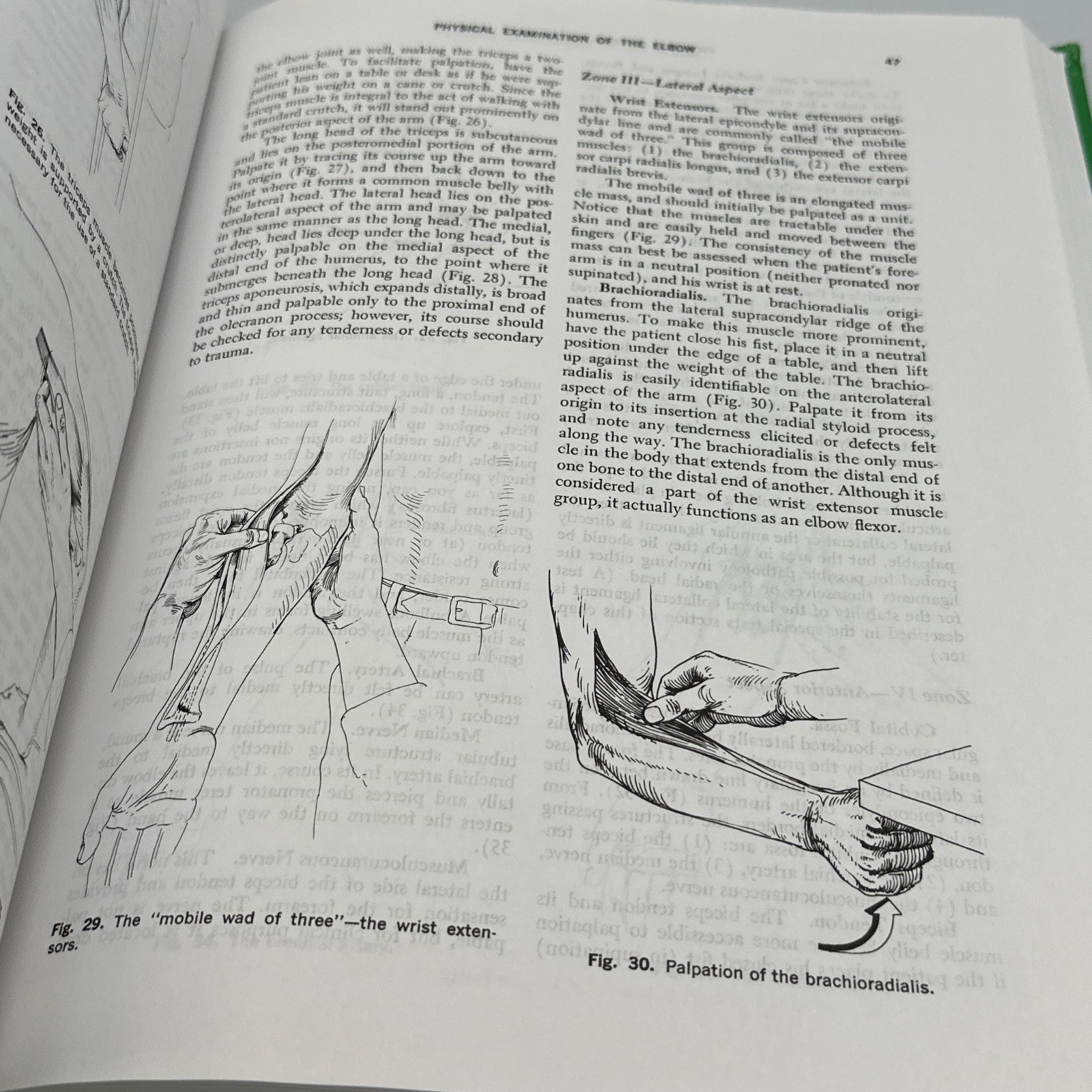 Physical Examination of the Spine and Extremities by Hoppenfeld (Hardcover, 1976