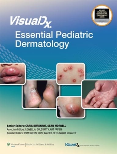 VisualDx: Essential Pediatric Dermatology by MPH Goldsmith, Lowell A., MD: Used