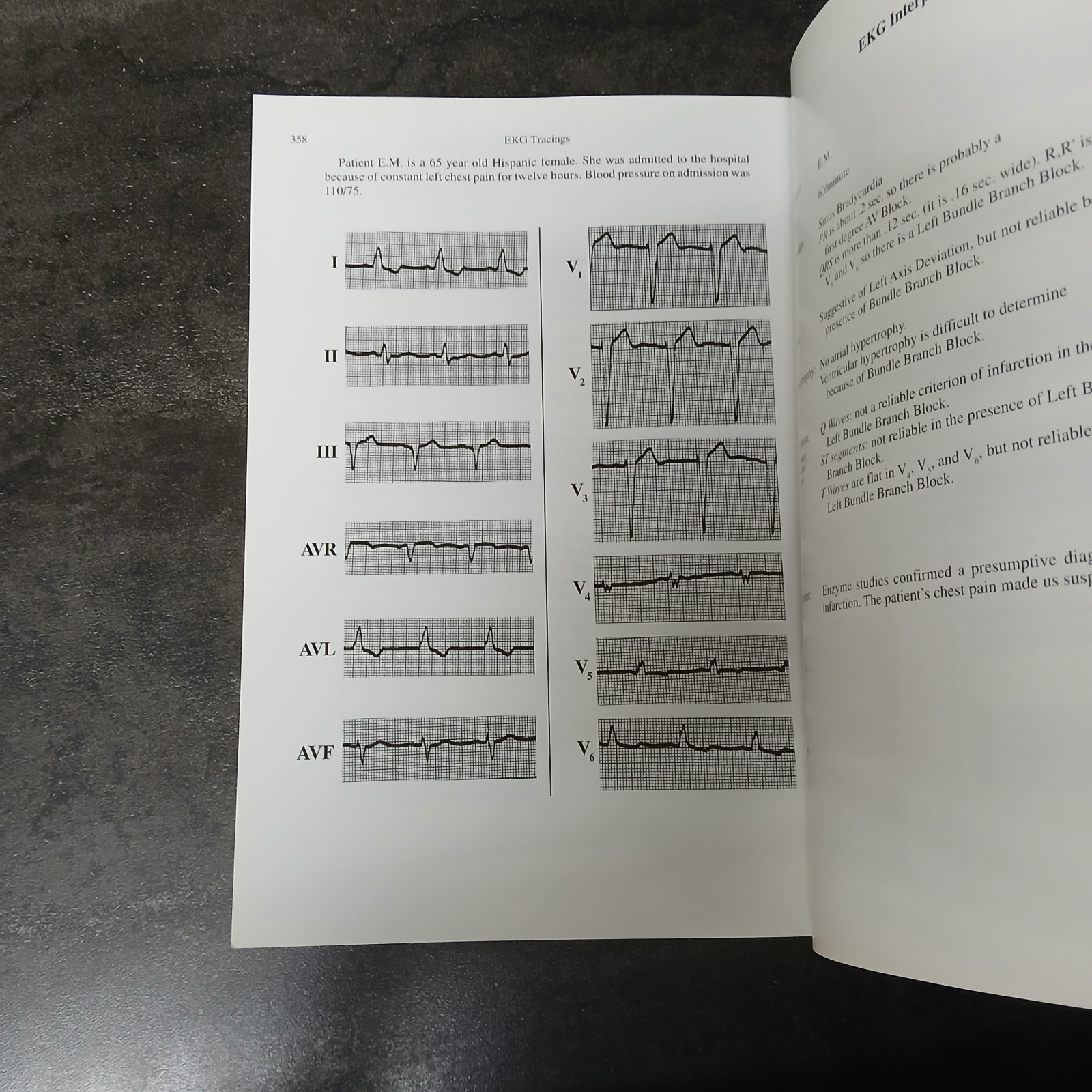 Rapid Interpretation of EKG’s 6th Edition Dale Dubin 2000 Paperback