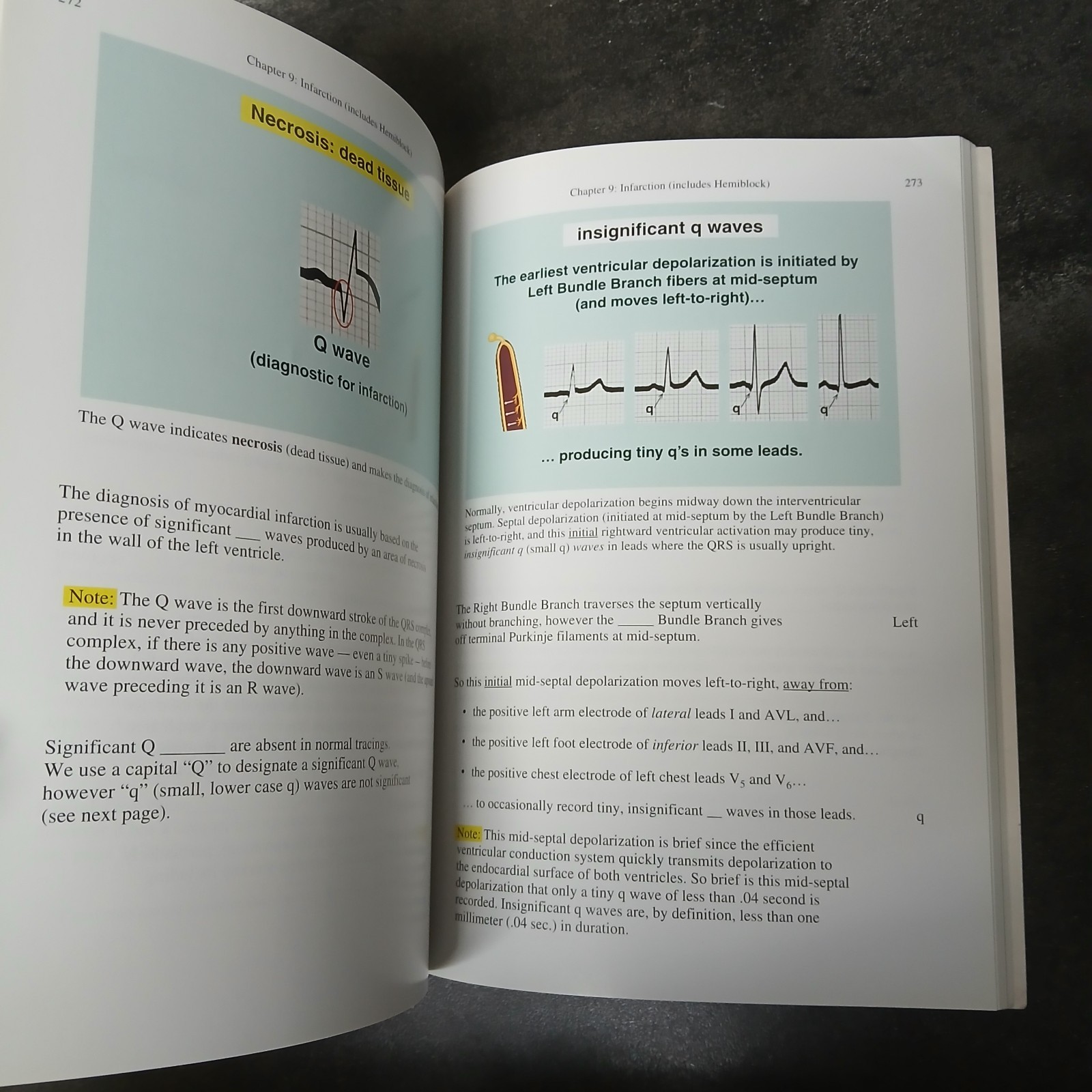 Rapid Interpretation of EKG’s 6th Edition Dale Dubin 2000 Paperback